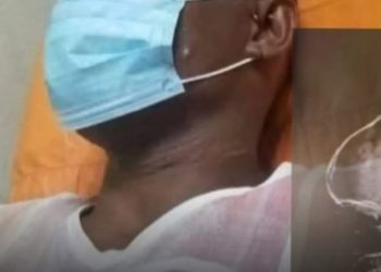 Hombre se clava clavo en la cabeza porque su cerebro estaba flojo