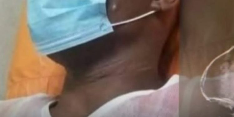 Hombre se clava clavo en la cabeza porque su cerebro estaba flojo
