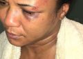 En Montecristi hombre que golpeó severamente su concubina fue apresado por la policía