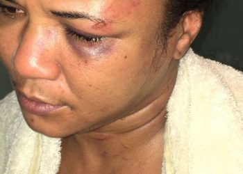 En Montecristi hombre que golpeó severamente su concubina fue apresado por la policía