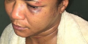 En Montecristi hombre que golpeó severamente su concubina fue apresado por la policía